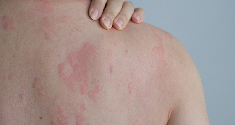 عوامل ایجاد حساسیت به فرش ماشینی